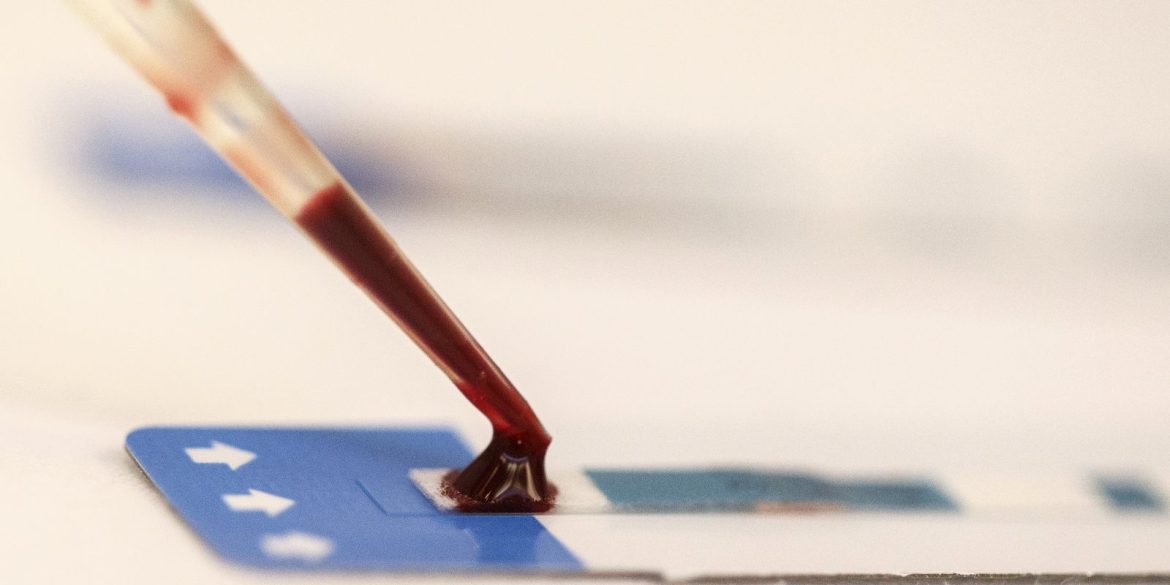 estudo-inedito-da-fiocruz-pode-ampliar-prevencao-de-hiv-entre-jovens